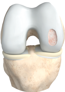 nrs-medical-step2-defektreinigung